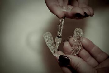 beljenje-zuba-stavljanje-gela-u-trej-350x234