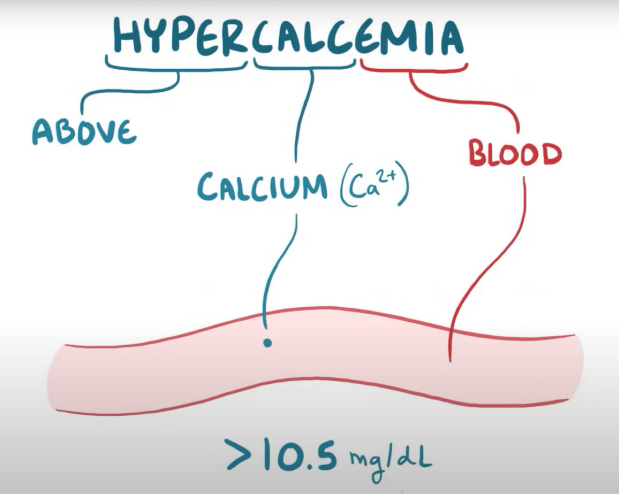 Simptomi hiperkalcemije: umor, mučnina, žeđ