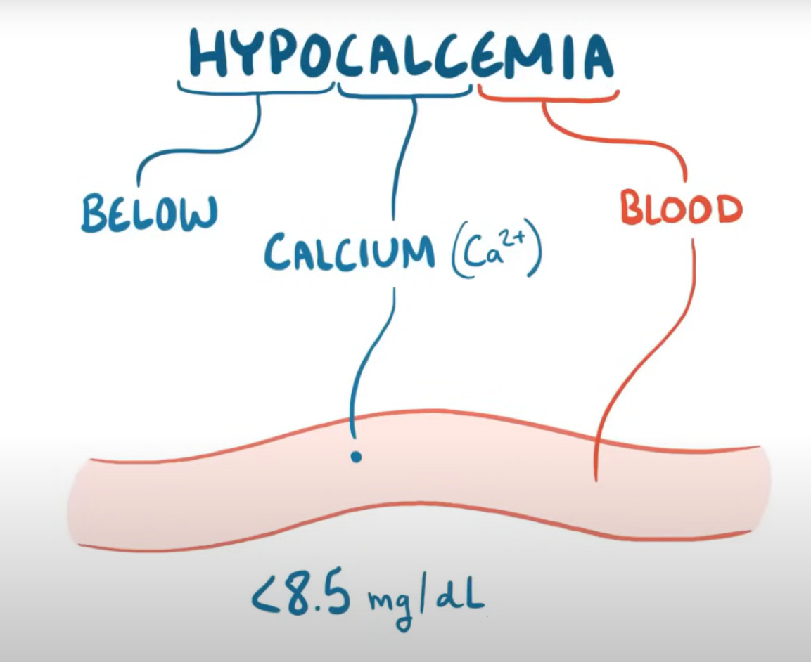Poreklo reči hipokalcemija