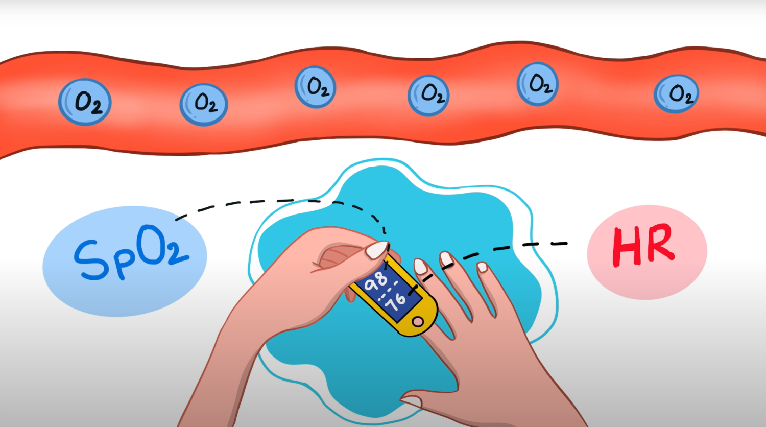Saturacija Kiseonika u Krvi: Sve Što Treba da Znate